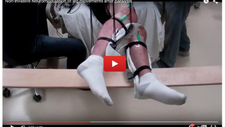paralysie-stimulateur électrique- paraplégie-Alexandre Hryb - etiopathe Cogolin - Saint Tropez - Sainte Maxime - Le Lavandou - La Londe